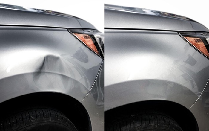 Boyasız Göçük Düzeltme